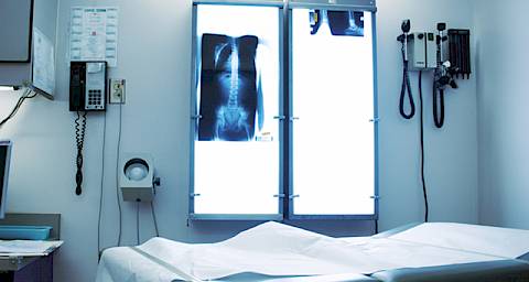 Osteoartritis ili artroza