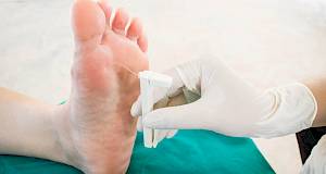 Dijabetičko stopalo – nastanak i liječenje