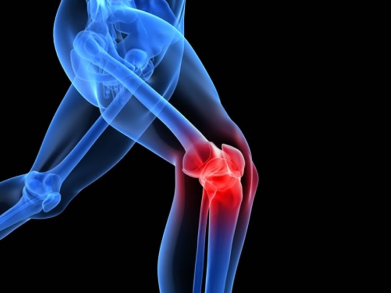 bol u potkoljeničnom zglobu fizičke vježbe za bolove u zglobovima koljena