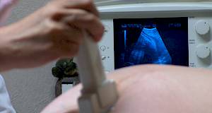 Rizična trudnoća stvarnost ili rezultat medicinskih dostignuća