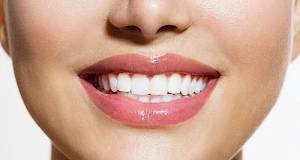 Briga o implantatima ne razlikuje se od brige o vlastitim zubima