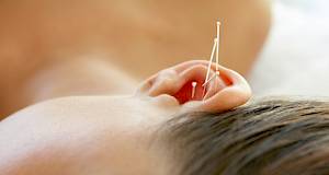 Kako vaše tijelo reagira na akupunkturu?