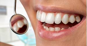 Što uzrokuje nastanak kamenca na zubima?