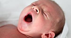 Kratkoročne komplikacije kod prijevremeno rođenih beba