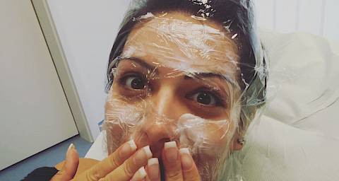 Isprobala sam vampirski tretman Angeline Jolie i Kim Kardashian! I znate što – jako mi se svidio!