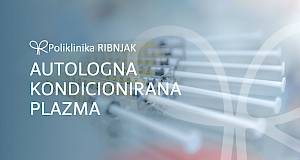 Poliklinika Ribnjak - Autologna kondicionirana plazma