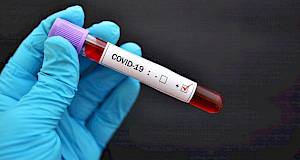 U Hrvatskoj započela ''drive in'' dijagnostika koronavirusa