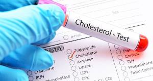 Kolesterol u krvi: idealne i povišene vrijednosti, posljedice i prevencija