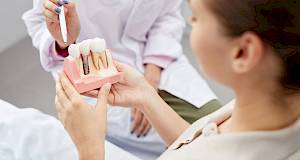 Stomatologinja o dentalnim implantatima: 10 mitova u koje morate prestati vjerovati