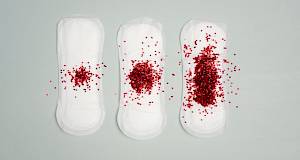 Pojačano menstrualno krvarenje - ovo su mogući uzroci